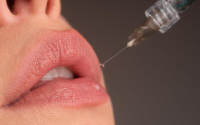 Labios en verano: cómo conseguir una hidratación y volumen natural en Pamplona antes de tus vacaciones